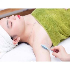 Triệt lông nách vĩnh viễn Cần Thơ