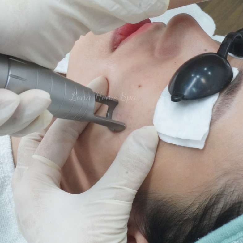 Trị nám da tại cần thơ với công nghệ tiên tiến tại spa điều trị nám da tại cần thơ