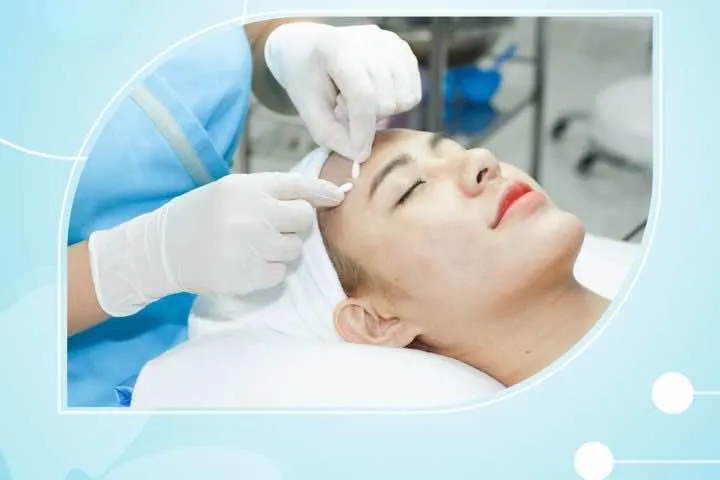 Kay Spa Trà Vinh trị mụn Trà Vinh