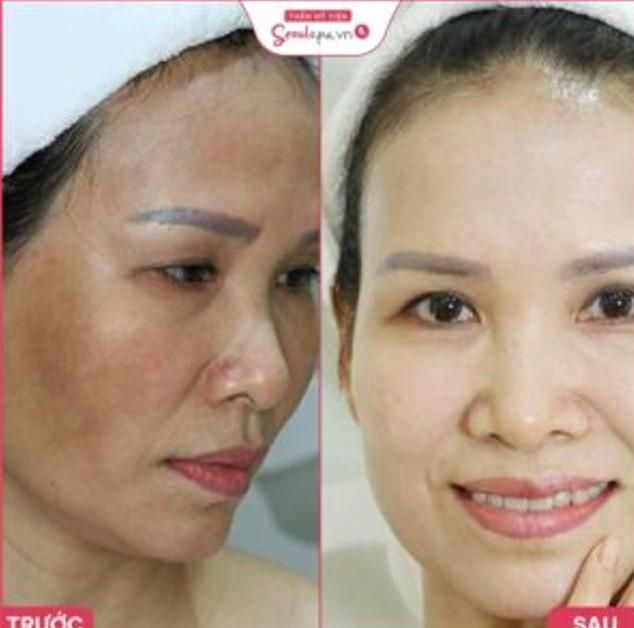 Thẩm Mỹ Viện SeoulSpa Bến Tre SeoulSpa Bến Tre - thẩm mỹ viện trị nám Bến Tre