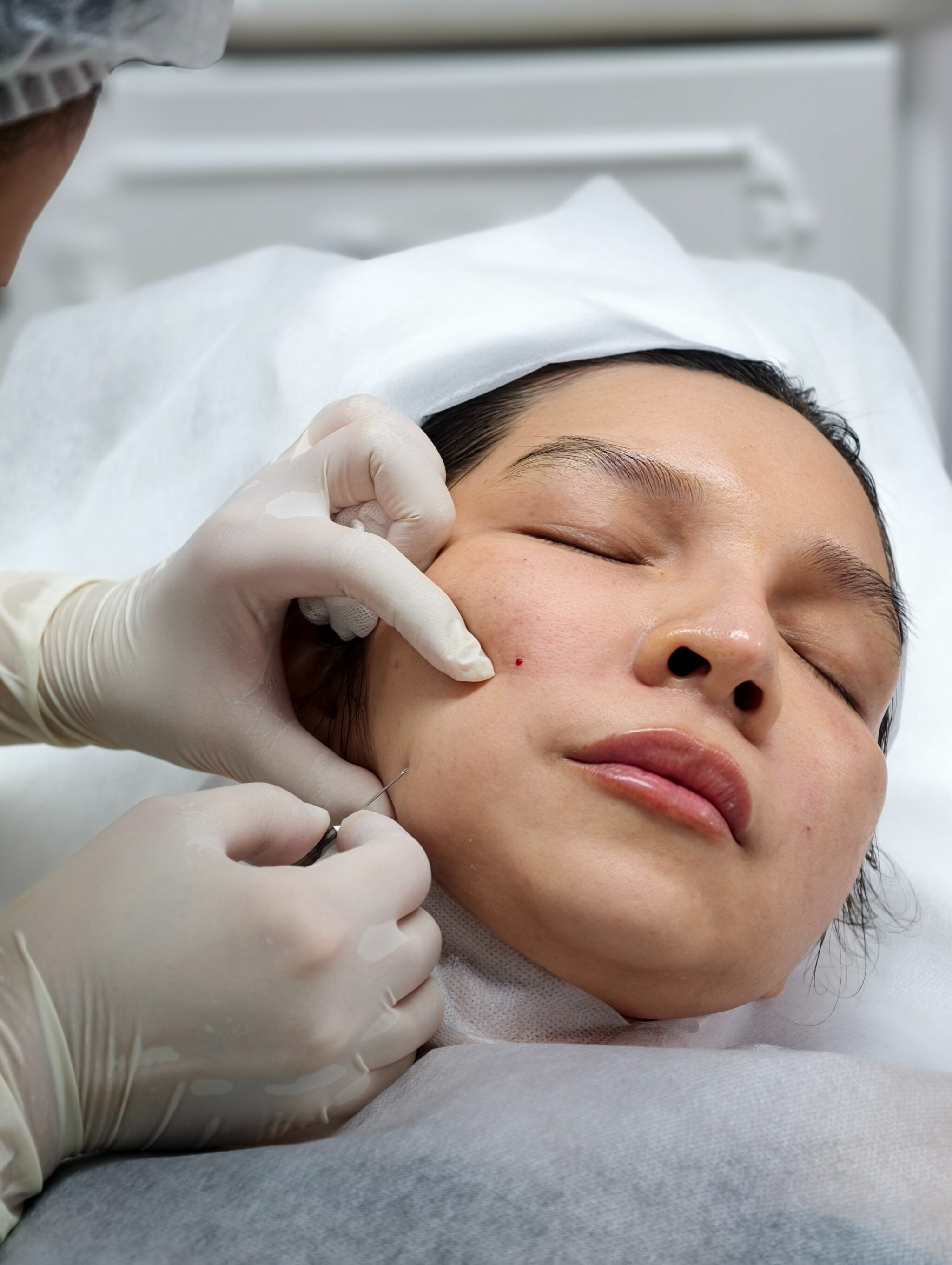 Minh họa quy trình điều trị đạt chuẩn của địa chỉ bác sĩ da liễu Bạc Liêu, với bác sĩ da liễu giỏi Bạc Liễu thực hiện khám da liễu Bạc Liễu tại môi trường phòng khám da liễu Bạc Liêu.