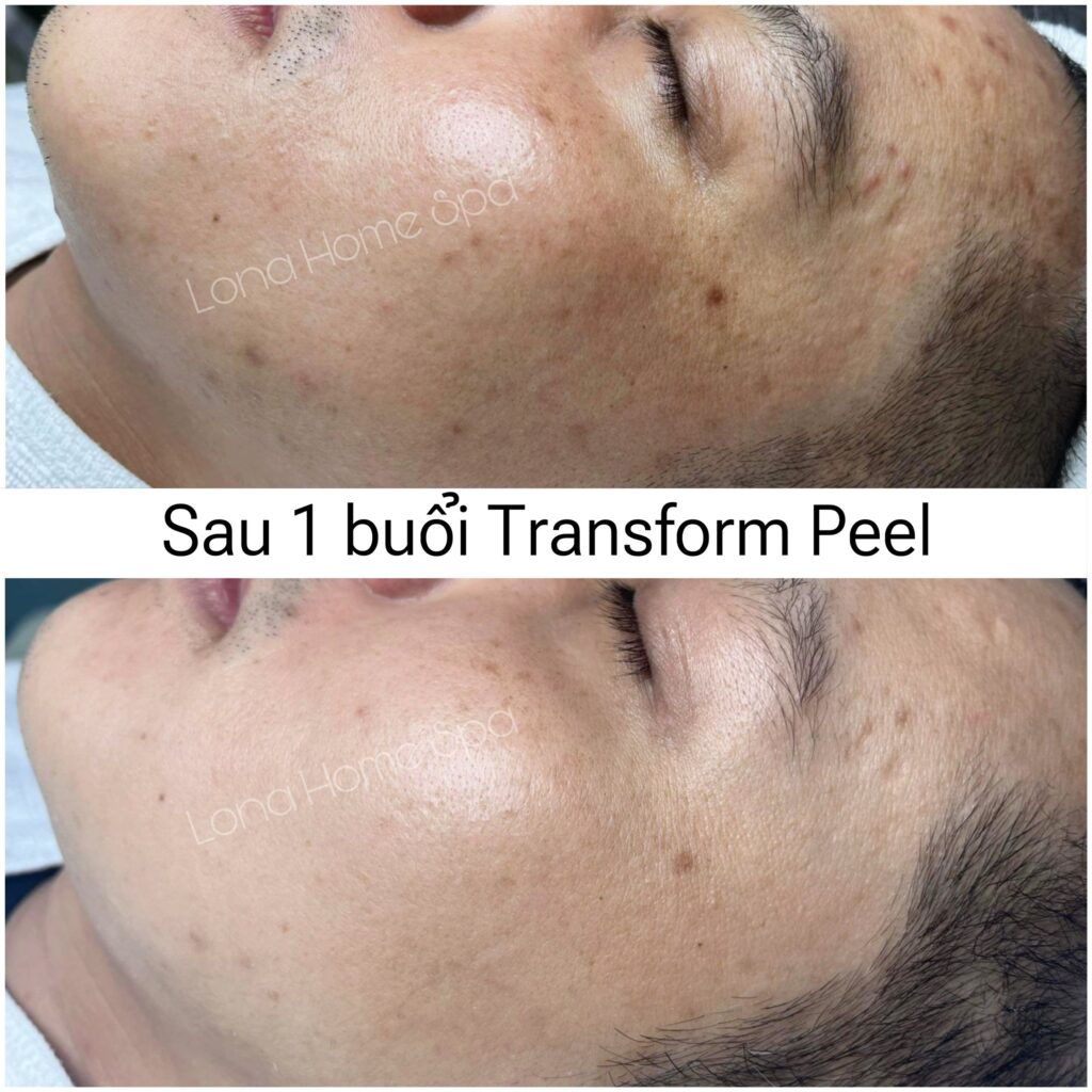 Minh chứng về hiệu quả điều trị của bác sĩ da liễu ở Bạc Liêu với quy trình khám da liễu Bạc Liêu hiện đại và đội ngũ bác sĩ da liễu Bạc Liễu tận tâm tại phòng khám da liễu Bạc Liêu.