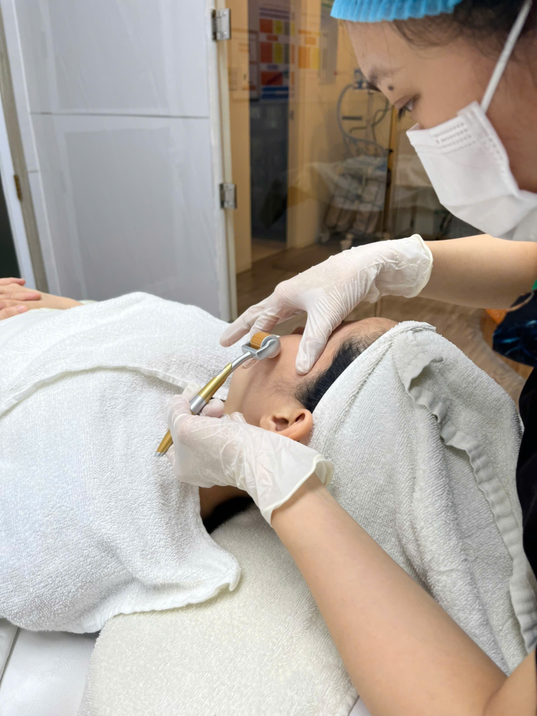 Trong hình ảnh, ta hình dung quá trình lăn kim trị nám tại Cần Thơ được thực hiện tỉ mỉ, khẳng định vai trò lăn kim trị nám tại Cần Thơ trong việc trị nám bằng lăn kim, dựa trên phương pháp lăn kim trị nám chuẩn mực do chuyên gia Lona trị nám chỉ đạo, góp phần cải thiện da qua lăn kim da mặt Cần Thơ.