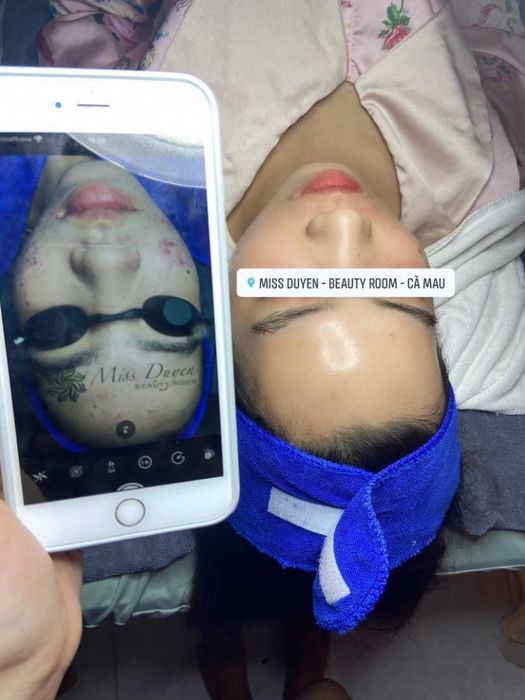 Top 9 Spa làm đẹp uy tín và chất lượng nhất Cà Mau - spa trị sẹo rỗ uy tín Cà Mau