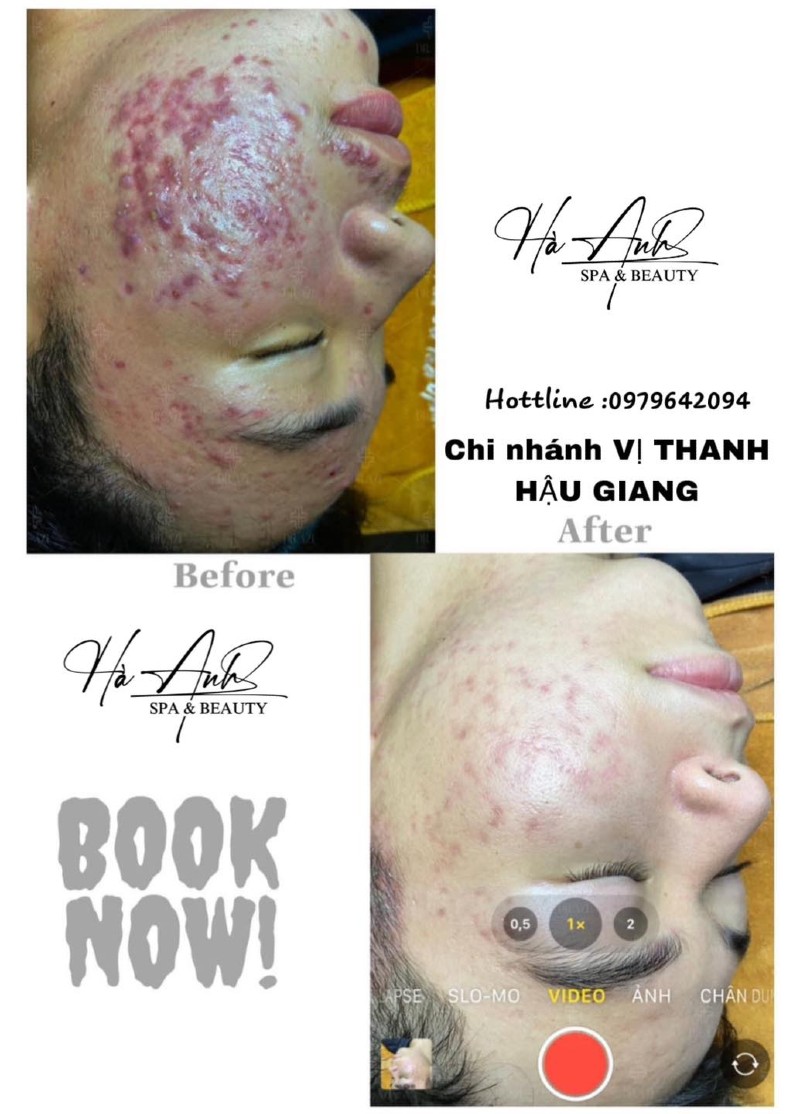 Spa Kiến Sanh Hậu Giang spa làm đẹp Hậu Giang - Spa Kiến Sanh