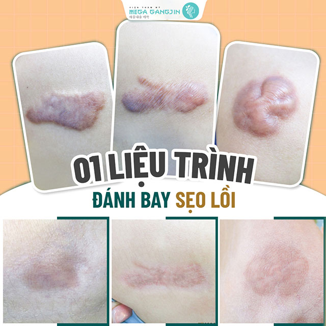 Viện Thẩm Mỹ Quốc Tế Maga GangJin Tiền Giang Viện Thẩm Mỹ Quốc Tế Maga GangJin Tiền Giang