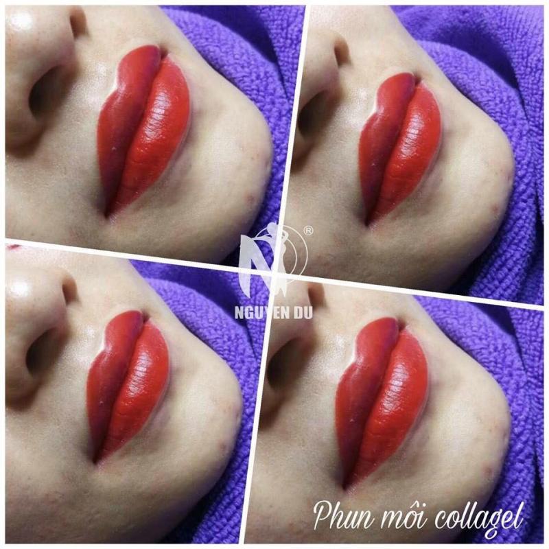 Viện Thẩm Mỹ Nguyễn Du - thẩm mỹ viện trị nám Long Xuyen