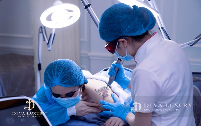 DIVA LUXURY Kiên Giang DIVA LUXURY - phi kim trị sẹo Kiên Giang