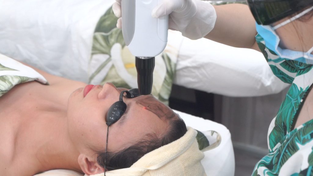 Khách đeo kính bảo hộ che mắt trong lúc kỹ thuật viên đưa đầu máy cầm tay lên vùng má — Lona Home Spa, Cần Thơ