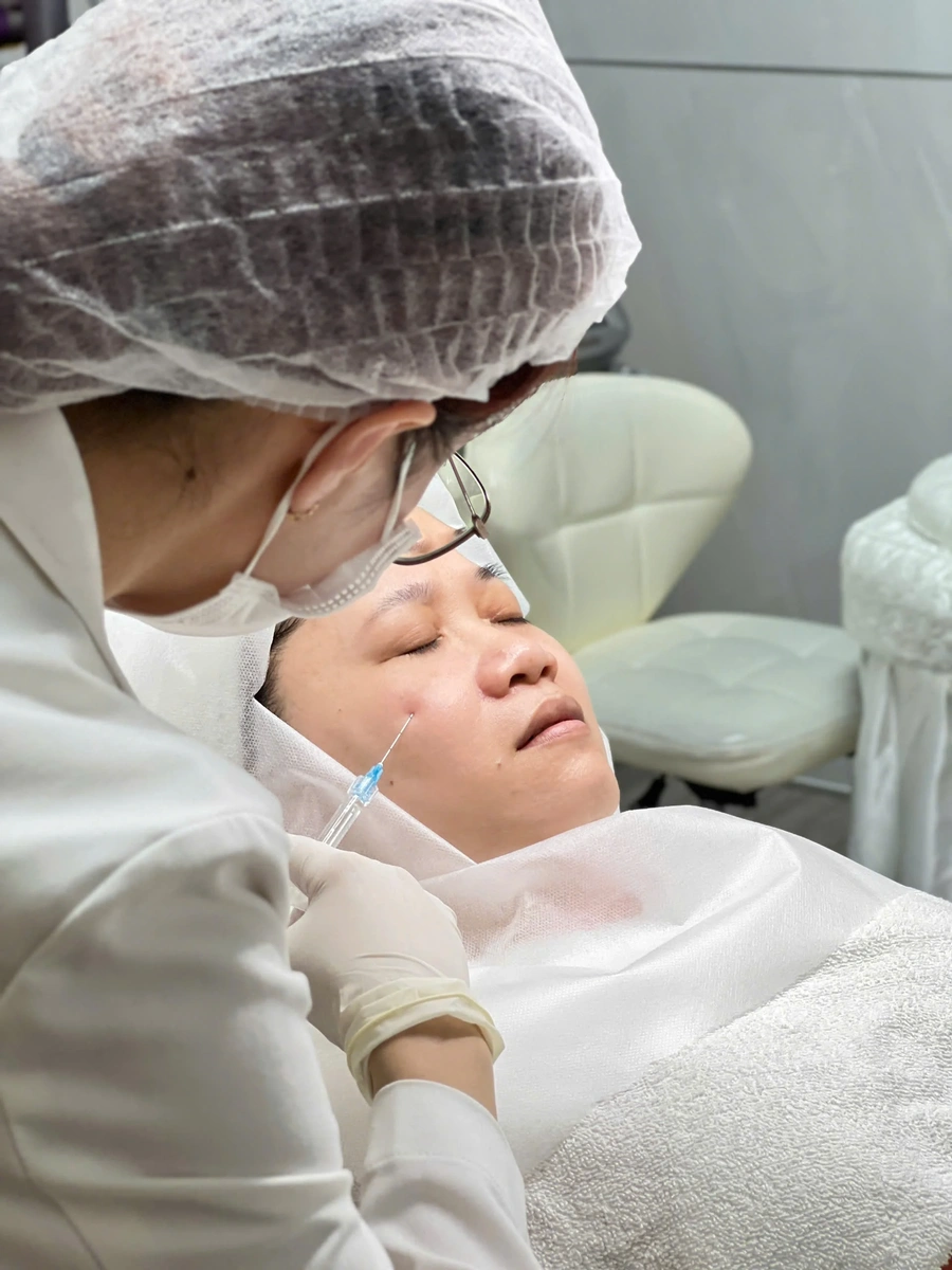 Tiêm filler tại Phòng khám da liễu Lona Skin Lab