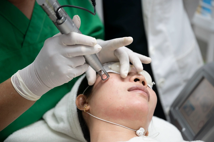 Trị nám tại Phòng khám da liễu Lona Skin Lab